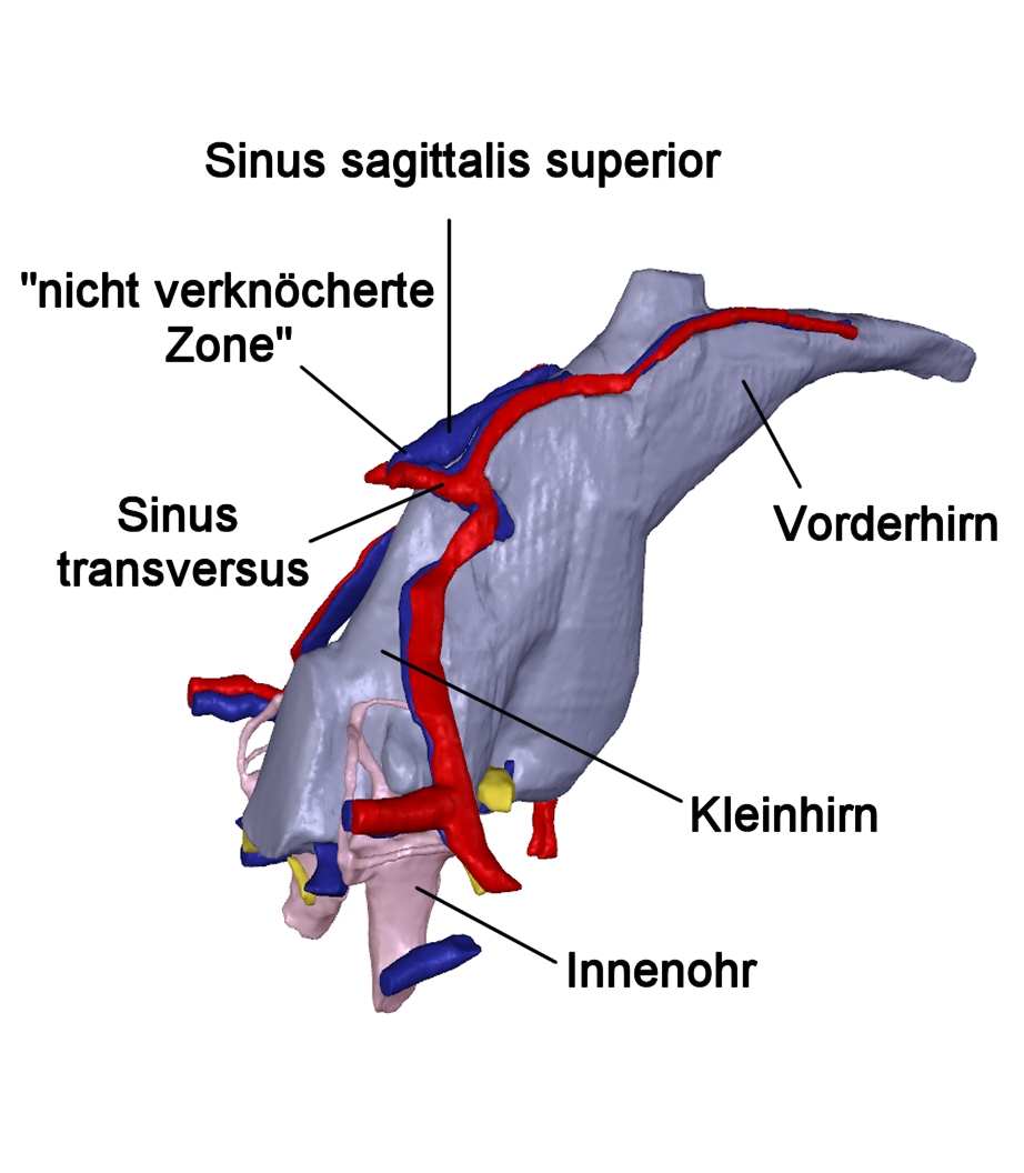 Rätsel um Beule in der Hirnkapsel gelöst