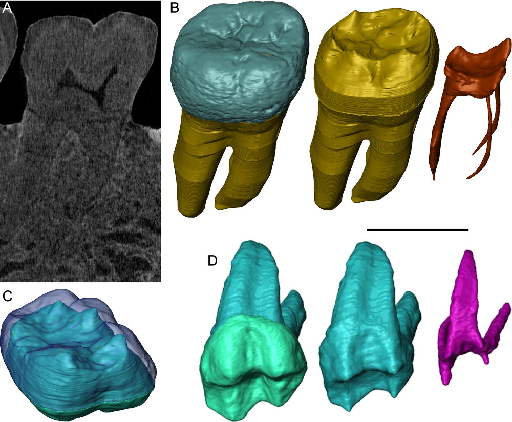 Deep look into teeth with neutrons